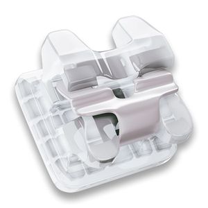 11.31.2143 Bráquete Cerâmico Autoligado Iceram Slb Mbt 0,022 (Dente 43 Com Gancho) - Orthometric